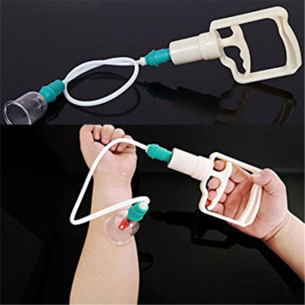 Kang Zhuci Cupping Device,Chinese Cupping Therapy Set