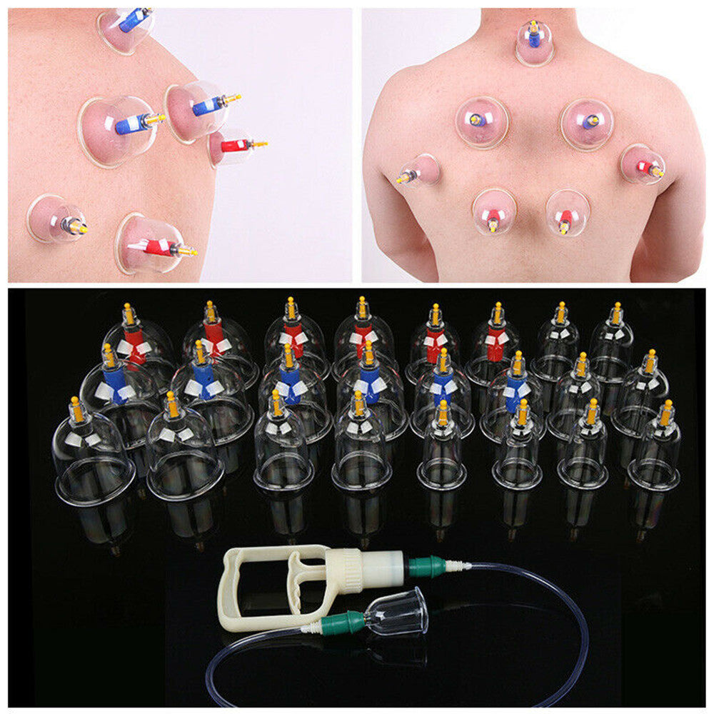 Kang Zhuci Cupping Device,Chinese Cupping Therapy Set