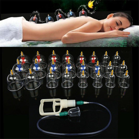 Kang Zhuci Cupping Device,Chinese Cupping Therapy Set